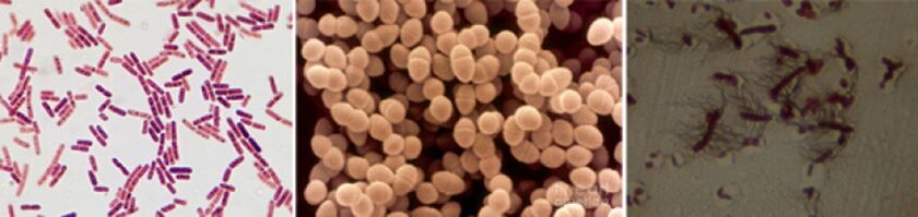 E. coli, gorotz enterokokoa eta proteusa dira bakteriaren prostatitis kronikoaren eragile nagusiak